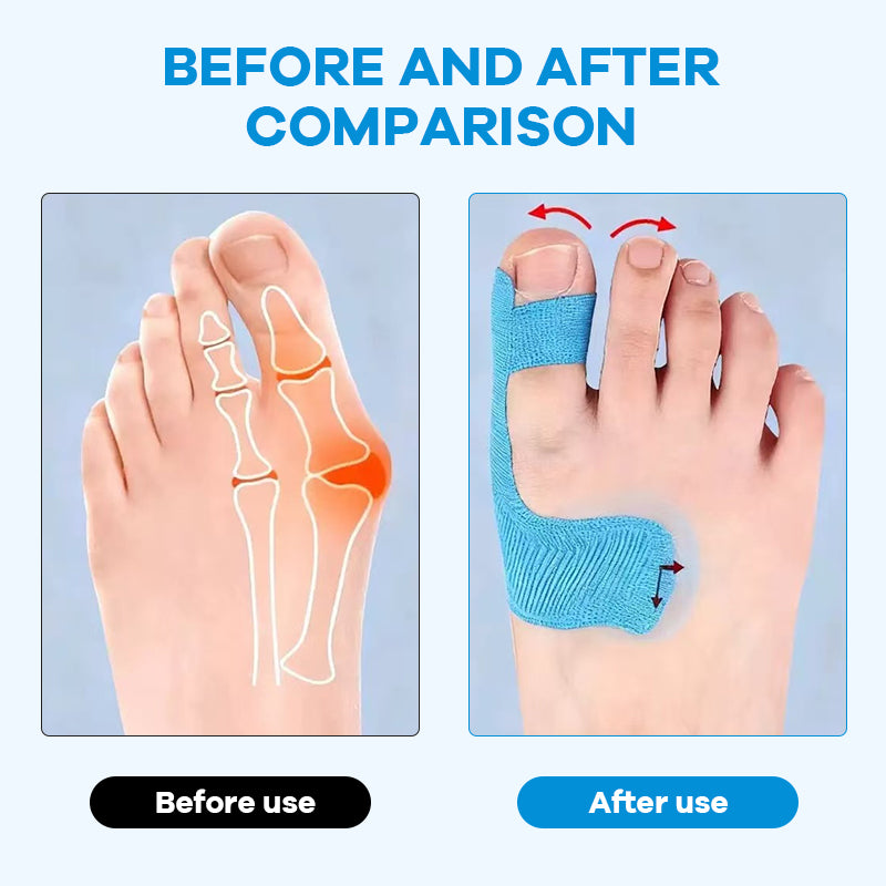 Unsichtbares Hallux Valgus Tape: Schmerzlinderung im Schuh 🦶✨