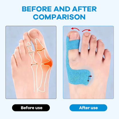 Unsichtbares Hallux Valgus Tape: Schmerzlinderung im Schuh 🦶✨