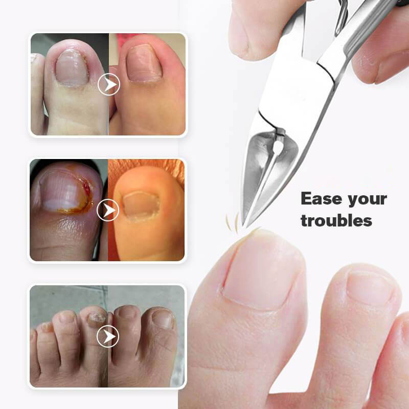 Nagelknipser in medizinischer Qualität