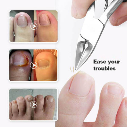 Nagelknipser in medizinischer Qualität